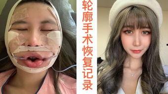 整容在线观看,揭秘美丽背后的秘密与挑战